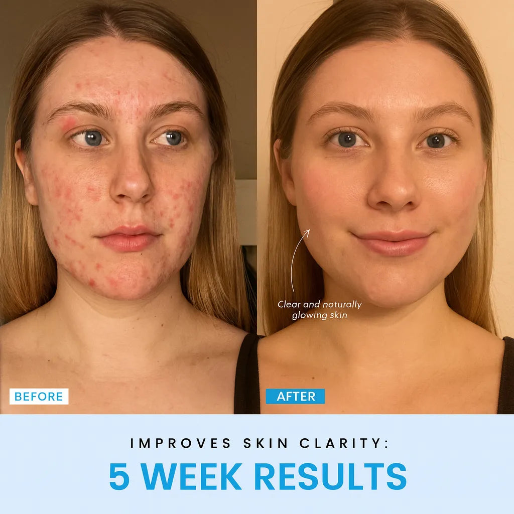 OpalLift Pro™ + Complimentary Serum