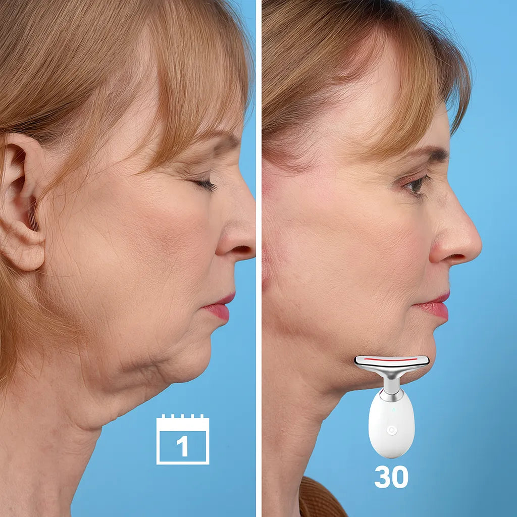 LiftIQ™ Device